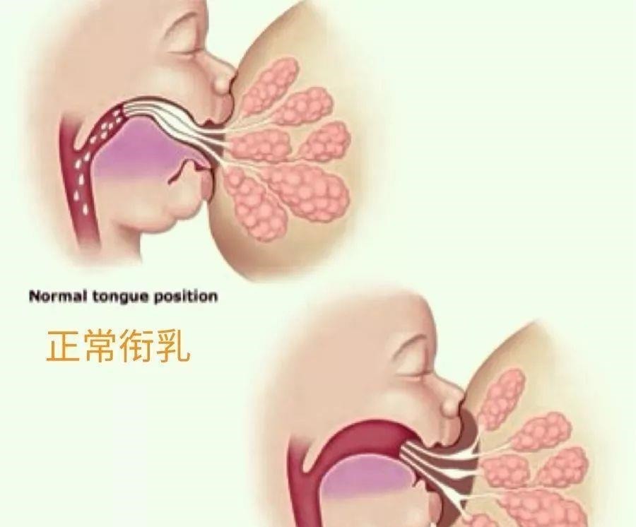 sh|宝宝舌头的形状可能影响孩子说话的早晚,父母要重视