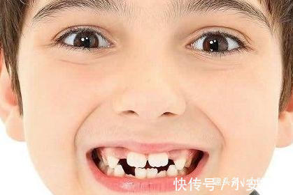 封建迷信|孩子乳牙掉了先别扔，关键时候能救命事情可能没你想的那么简单