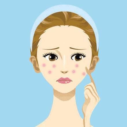 明星也会的护肤技巧，两分钟学会祛痘不留疤