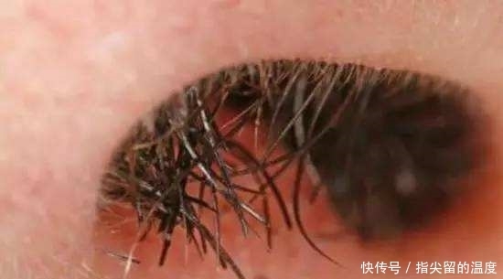 中医基础理论|中年人鼻毛变白,说明什么?