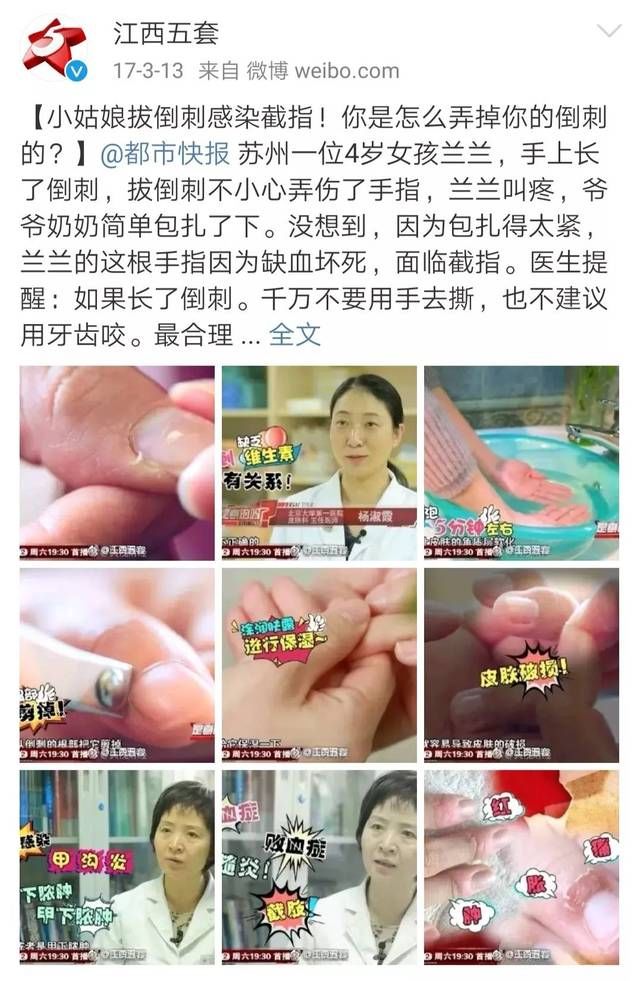 宝宝手指|女童手指感染，面临截指？！只因这一常见的举动，爷爷奶奶后悔不已...