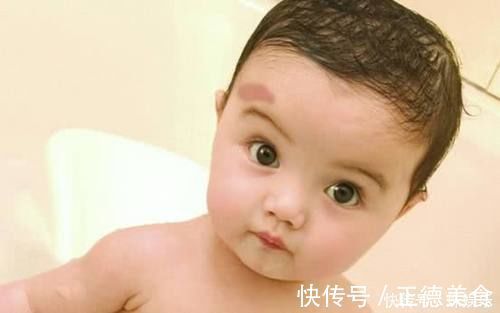 小张|孕期不经意的这几种行为,很容易让“胎记”找上宝宝,孕妈别大意