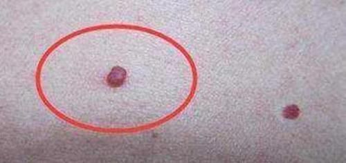 此物是天然“解毒王”,每天常吃点,养肝排毒,肝病或不攻自破