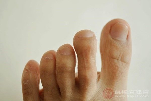 指甲长到肉里怎么办