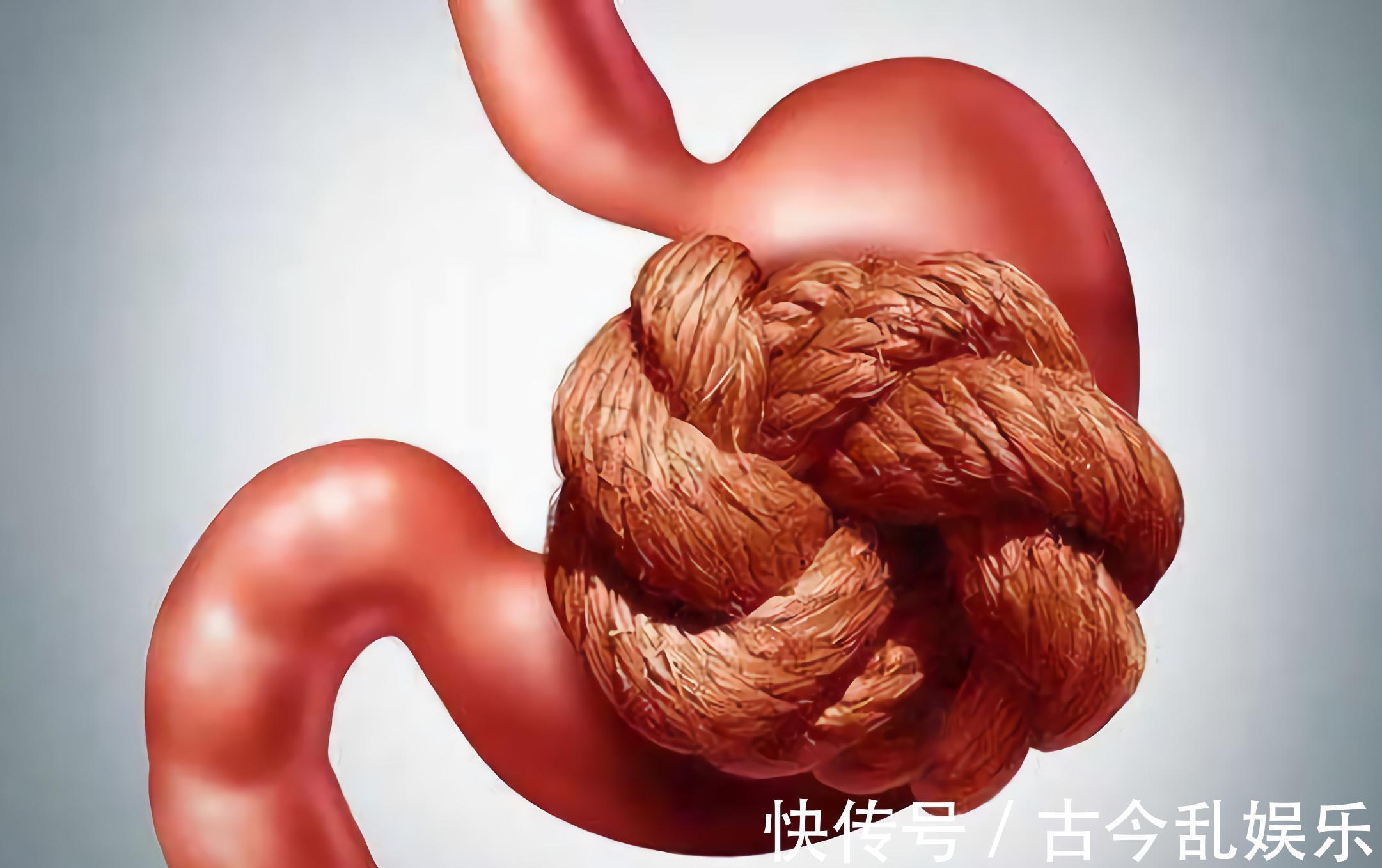 枯草杆菌|常吃这种五谷之王,保护血管,清理肠道,还能降三高、增强免疫力