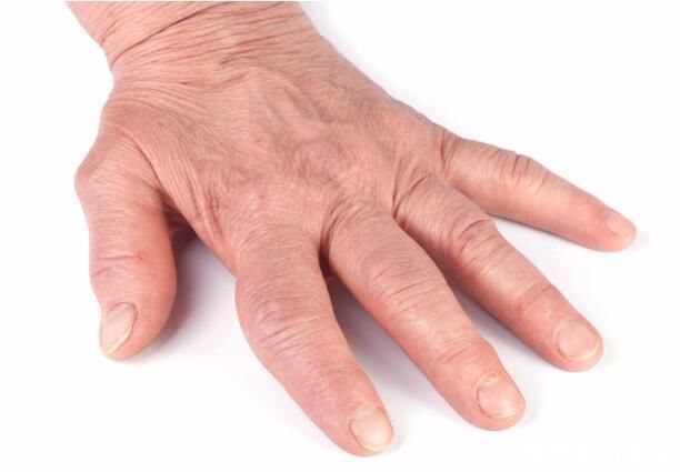 信号|近期手脚突然莫名出现以下几个症状,当心就是癌变已经敲响了信号