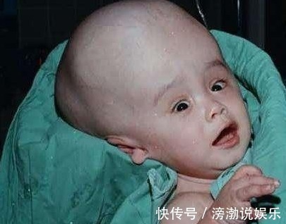 叶酸|怀孕20周,四维彩超却发现胎儿畸形,闻到孕妇身上的味道明白了