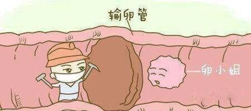 剖腹产|二胎剖腹时要不要结扎?过来人:关键看夫妻两人感情好不好