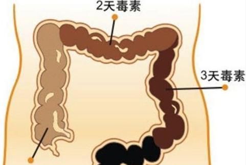 “便秘”老是不好？专家教你2招，可根除你的“便秘体质 ”