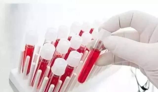 胆固醇|高血脂真正敌人并非肥肉,该忌口了,别等血管堵塞,脑梗来才后悔