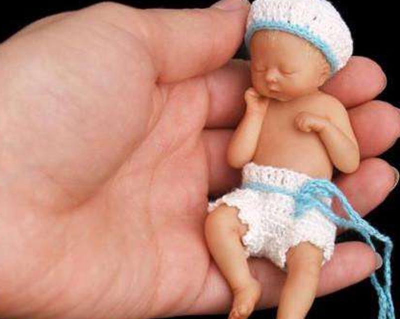 提前|她是世界上最小的婴儿，提前4个月出生，专家称违背医学规律