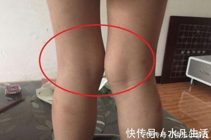 大长腿|家长带孩子“泡脚”,或会耽误娃的脚部发育,现在改还来得及