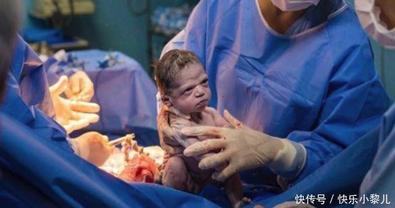 巴西“臭脸”宝宝走红，怒瞪医生引大笑，网友：表情包出炉