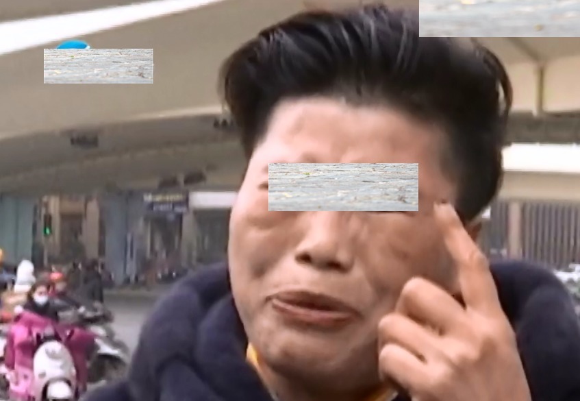 大哭|河南女子整容失败崩溃大哭:以前都叫我万人迷,现在整得像妖怪