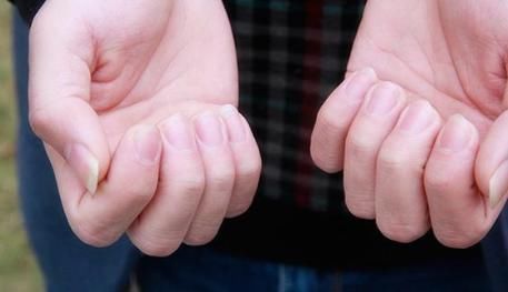 身体|女人突然手麻,一个决定,救了自己一命,专家:身体变化要留意