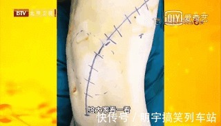 自测|血管有多硬?两个方法,自测动脉硬化风险,提前消除隐患