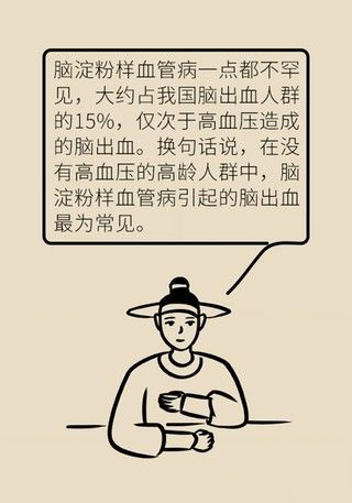 瞌睡|记性变差容易瞌睡，有可能是这种脑出血