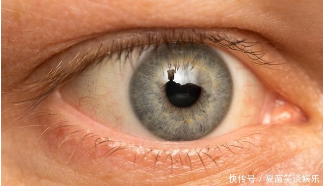 血脂升高|血脂高不高，看头就知道，若没有4种症状，恭喜，血管还算通畅