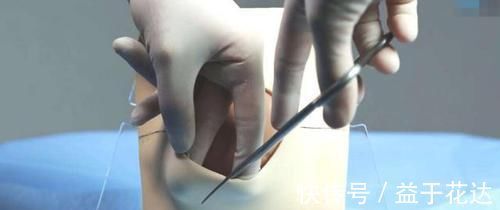 疼痛|顺产为何让妈妈们如此恐惧?一般都会经历什么?