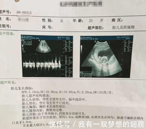 准妈妈|B超单上的这4个字是什么意思 别担心, 别人羡慕还来不及呢！