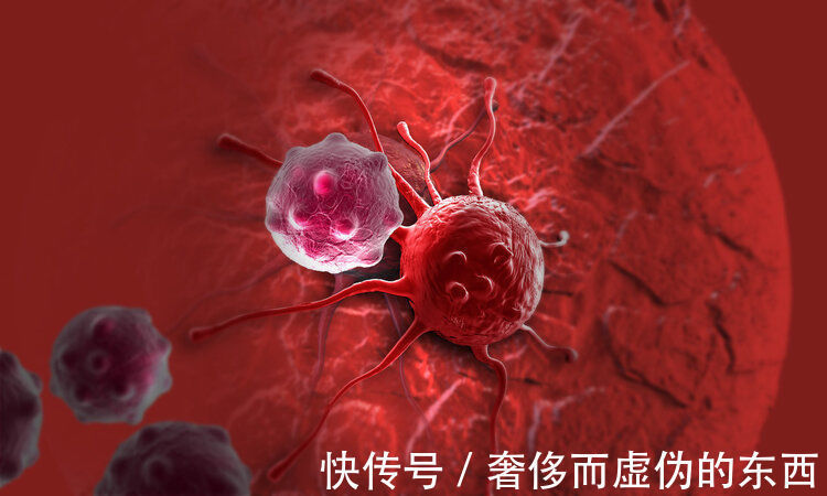 肿瘤|抗癌的关键不是手术患癌14年无复发，肿瘤院长劝人别轻易开刀