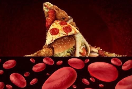 血管疾病|真正的“降脂冠军”出现了，洋葱靠边站，水里放一点，远离高血脂