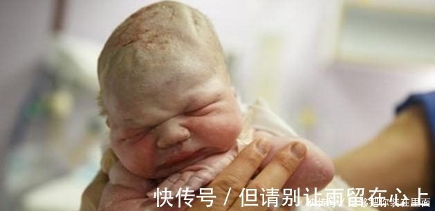 亲子关系|剖腹产生宝宝时要让产妇亲吻宝宝?别小看这个环节,有这四个意义