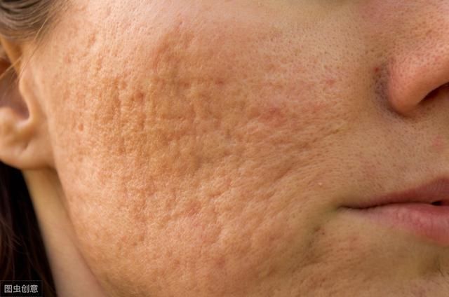 毛孔越来越粗大,这些坏习惯你却一直在做,别再怪护肤没用了!