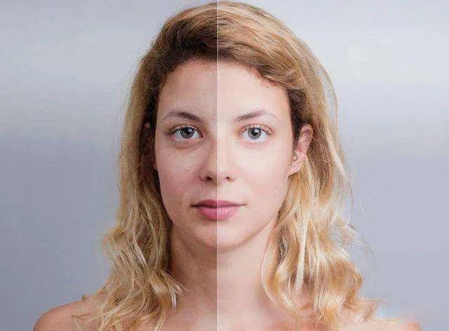 熬夜 经常熬夜该如何拯救“崩掉”的颜值?4大医美黑科技来了~