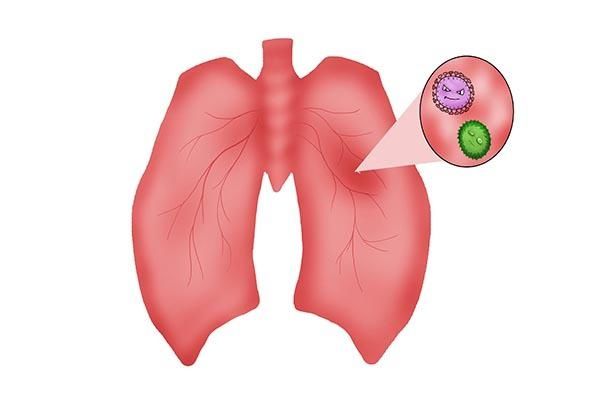 标志物|肿瘤标志物超正常10倍，吓坏女士，检查结果却是正常？为什么？