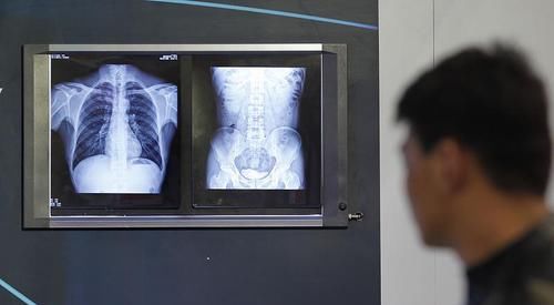  过程中|体检查出肺部有阴影，多有4种可能，别胡思乱想