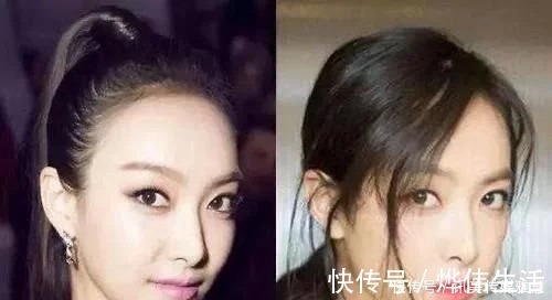 女生 发际线比较高的女生,尽量少梳这3种发型,否则发际线会上移!