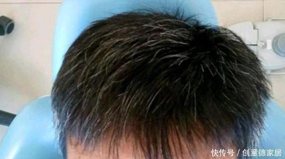 秘方|民间一个土秘方,不论白发多严重,让你从此告别染发,非常的实用