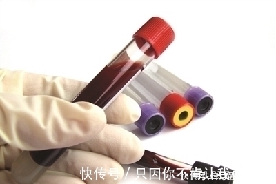 空腹血糖|查血糖总是在72左右,需不需服降糖药搞清这四个细节就知道