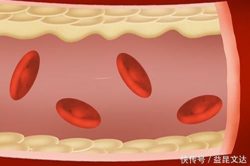 手肘|男人50岁后,天天做俯卧撑,会有什么变化?一次做多少个比较好?