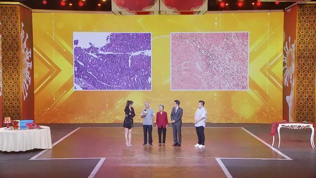 直肠癌|全新抗癌疗法!直肠癌中晚期,不开刀,肿瘤细胞竟然完全消失了