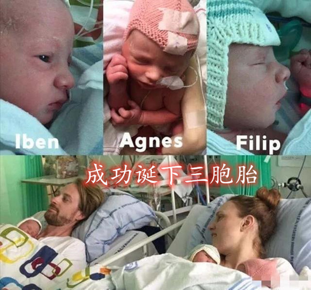 妈妈|丹麦妈妈怀上三胞胎，产后肚皮却“收不回去”，看完照片感同身受