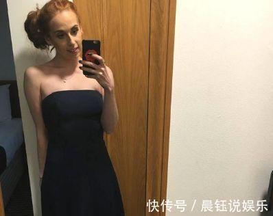 减肥法|女孩为减肥染上厌食症,为当伴娘增肥40斤,出现的时候惊艳全场