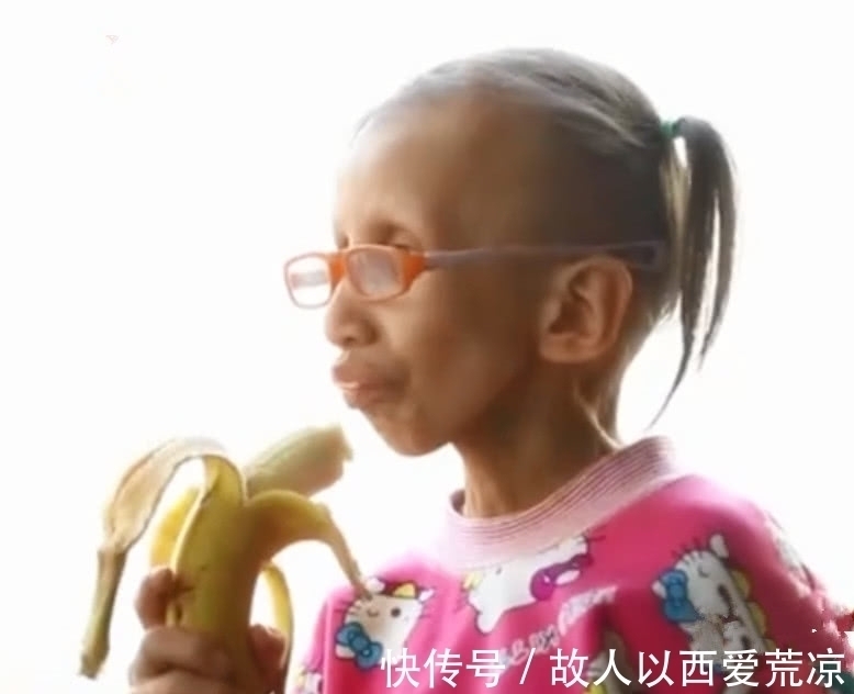 医生|14岁女孩像80岁老人,做完手术的1句话,让医生父母纷纷落泪