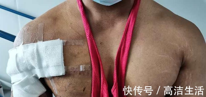 胸大肌|健身教练卧举380斤失败胸大肌被生生撕脱