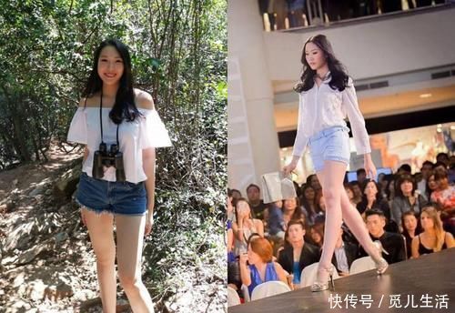 女模特为参加婚礼去做抽脂手术，结果发生意外死在手术台上