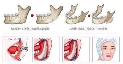 发型师脸平脖子粗还想找我剪短发不约