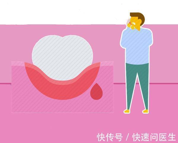 无视|癌症来临前，身体可能有4个异常表现，可惜很多人都无视了