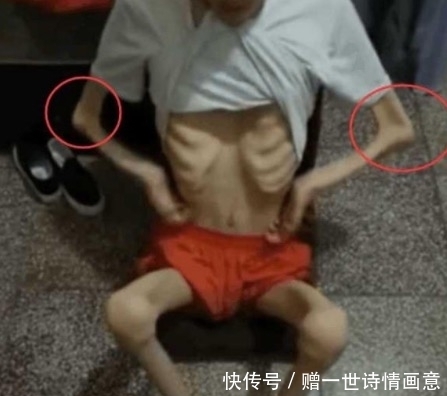 男孩|男孩瘦成皮包骨头，医院检查没病，了解过后才知道另有原因