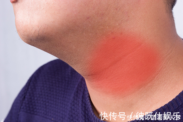 手术切除|化疗有什么用得了癌症就一定要化疗