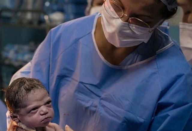 弄出来|“就是你把我弄出来的”宝宝出生时脸太臭,医生都被盯毛了