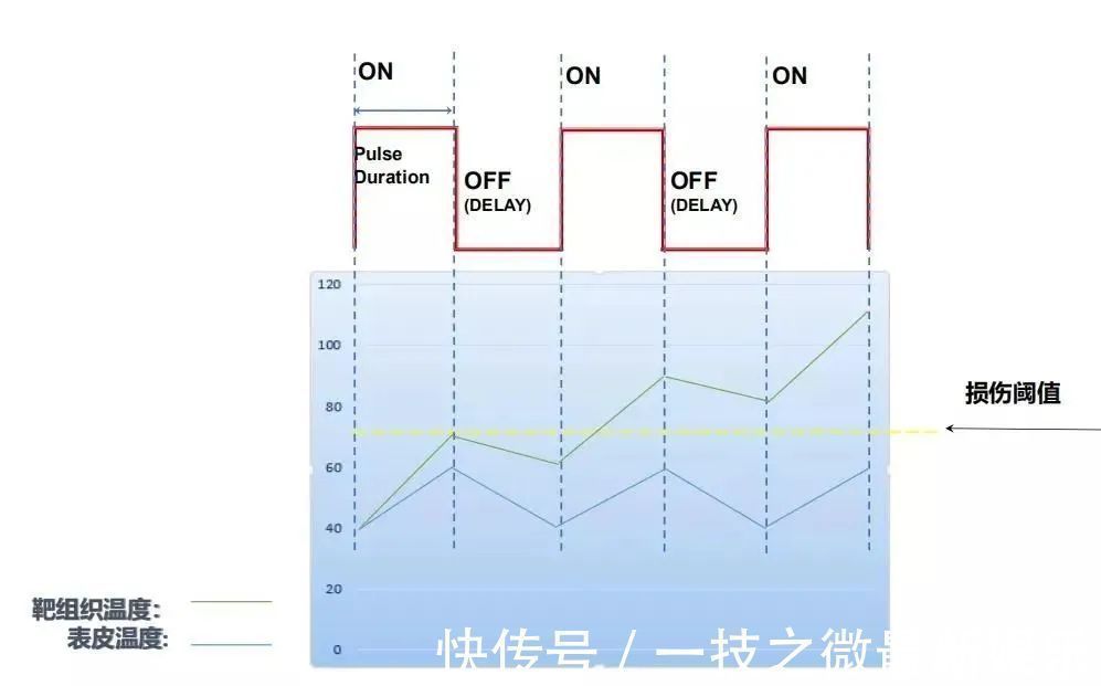 皮肤 光子嫩肤种类那么多,为什么建议使用OPT技术的仪器