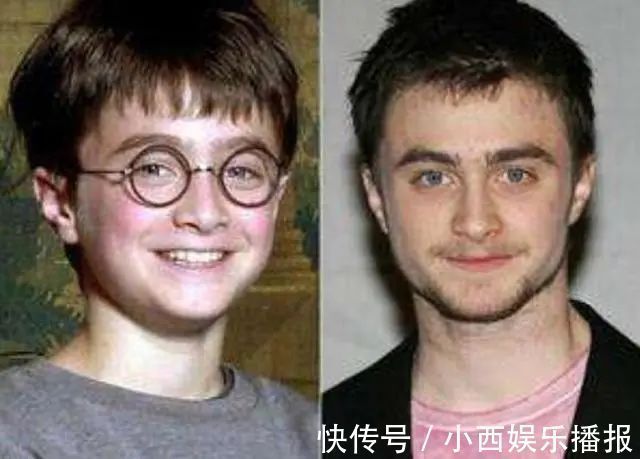 孩子|这5种孩子小时候好看也没用，只会越长越丑，你家孩子有中招吗？