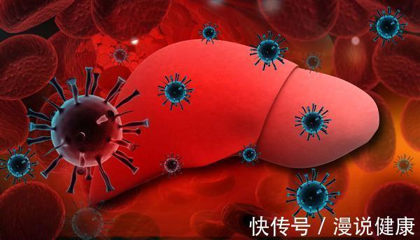 肝炎|肝硬化的元凶找到了,吃饭2坚持,晚上3不要,肝脏一天比一天弹软