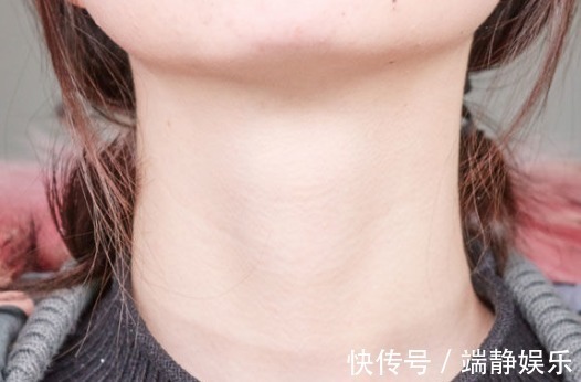 患有甲状腺结节|甲状腺结节出现时,尽量少碰“3种”食物,可使结节慢慢变小!